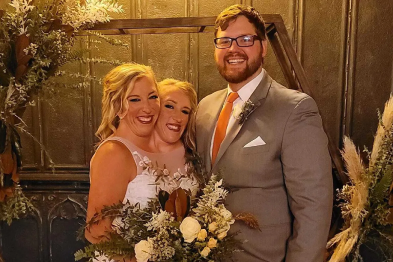 “Abby Hensel’s Joyous Wedding: A Celebration of Love” Bio & Wiki, Net Worth, Personal Life And More..