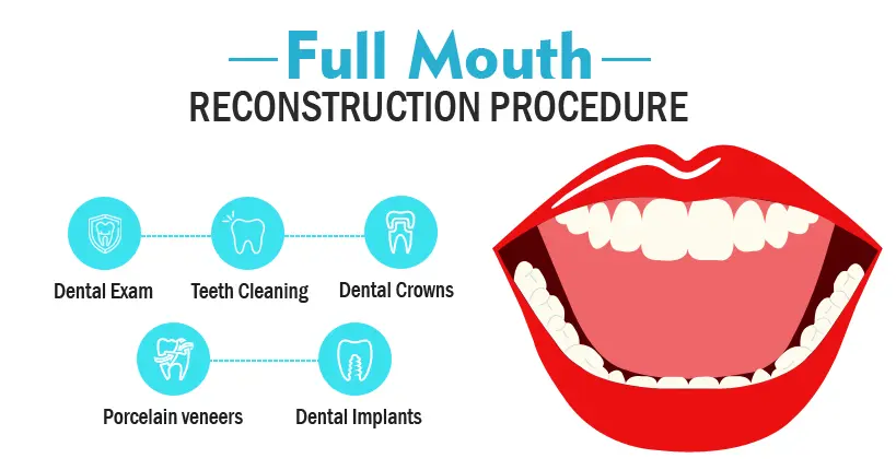 Mouth Reconstruction